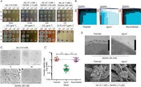Move your business forward with confidence. Targeting A Critical Step In Fungal Hexosamine Biosynthesis Journal Of Biological Chemistry