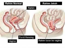 Kebanyakan perubahan akibat penyakit kulit, mengapa ianya berlaku serta puncanya. Sakit Tumit Pinggang Tanda Rahim Tidak Sihat April 2021 Kelabmama Malaysia