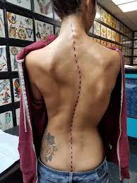 Scoliosis Tattoo Scoliosis Tattoo Spine Tattoos Spine Tattoos For Women