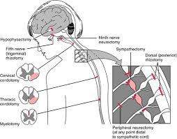 Pin On Thoracic Outlet Syndrome