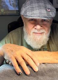 Asher Benrubi "The Smash"