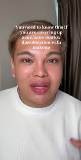 Number 1 concern ay bakit daw nagccrack ang makeup. Bakit daw nagcacake.  Remember guys your makeup can only be as good as your skin will allow it.  Normal naman mag acne/discolotation treatments ...