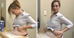 For the female members of the kayan lahwi tribe in northern thailand, the brass rings they are famed for wearing in order to give the impression of having an elongated neck has led to the nickname of the. 255 Unbelievable Before After Transformation Pics That Show If They Could Do It So Can You Bored Panda