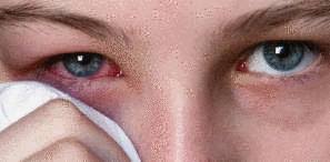 We did not find results for: Yeux Qui Piquent Et Yeux Qui Pleurent Que Faire Tout Pratique