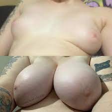 Real breast expansion