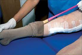 Thigh Length Compression Stockings And Dvt After Stroke The Lancet