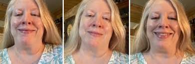 What are your suggested products for reducing redness caused by sun damage?