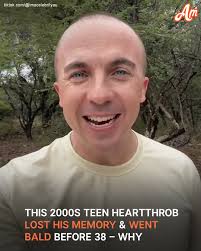 This 2000s prodigy, who lost his memory and left Hollywood, was nominated  for a Golden Globe before 18 and WENT BALD before 38. Details and his  before and after photos are in