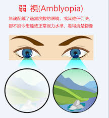 See more of 不甘視弱手工皂—新竹縣視障就業推廣 on facebook. å¼±è¦ è¦åä¸­å¿ é¦æ¸¯ æéå¬å¸