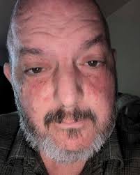 Fundraiser for Gary Welling by Melanie Suzann Hoy : Gary Needs Your Help  for Daily Needs