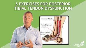 3 Exercises For Posterior Tibial Tendon Dysfunction Youtube