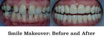 Our cosmetic dentists specializes in veneers, crowns, orthodontics, teeth whitening, . Affordable Cosmetic Dentistry Near Me Dental News Network