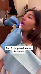 How retainers are made 🦷 #orthodontist #retainers#braces