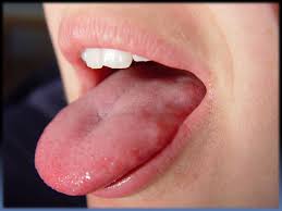 Maybe you would like to learn more about one of these? The Taste Bud Map Myth