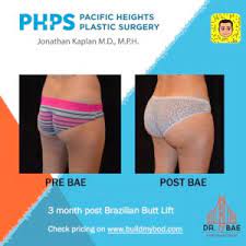 My advice would be to only do the procedure once. Brazilian Butt Lift Cost Plastic Surgeon San Francisco Pacific Heights Plastic Surgery