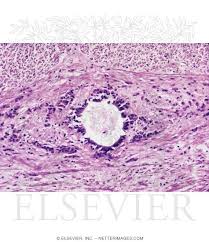 Nuclei 2 introduction to anatomy author: Light Micrograph Of The Central Canal Of The Spinal Cord In Transverse Section