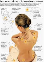 Un desafío para la neurociencia. Fibromialgia Viviendo En Un Mundo De Dolor Cerer