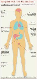 Primary renal damage is the most complicated cause of renal failure (accounts for 25% to 40% of cases). Acute Kidney Injury Causes Phases And Early Detection American Nurse