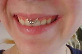 Smiley piercing healing and aftercare. Smiley Piercing With Silver Bead Ring