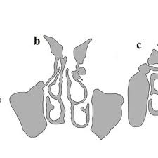 There are four pairs of sinuses (named for the skull bones in which they're located). 3d Nasal Cavity Geometry Of A Healthy Normal Subject And Download Scientific Diagram