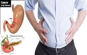 When cancer from the cervix spreads to other tissues and organs, it creates abnormal capillaries, which can be quickly and lead to abnormal bleeding. Serious Health Conditions Stomach Bloating Can Signal Inminutes Magazine