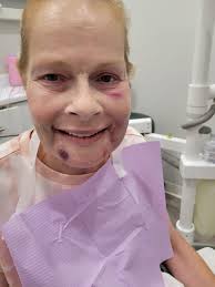 Just got torqued. New Smile! Excited and blessed to all that helped get me  here. So happy!