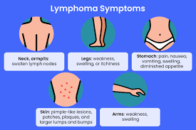 Image result for Lymphoma