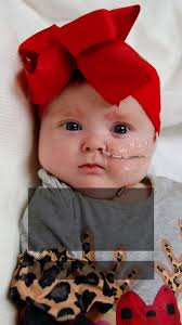 Brittney and Matt McLaughlin were overjoyed to welcome triplets in January  2019 at a hospital near their Mississippi home. Shortly after birth,  doctors discovered that one of the babies, Miller, had amniotic