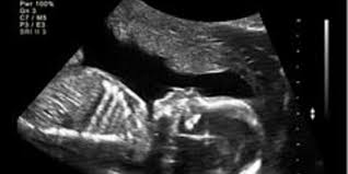 Eine werdende mutter will ein erinnerungsbild oder ein erinnerungsvideo haben. 3d Ultraschall Alle Infos Zu Kosten Risiken Und Zeitpunkt Familie De