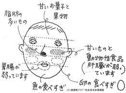 手のアトピーの原因は明確だから治しやすい アトピーリベレーション 2021 湿疹 アトピー 代替療法
