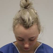 Frisuren 2018 Ab 40 Frisuren 2018 Ab 40 Coole Frisuren Pro Die Frau Ab 40 Jahre 2018 Yout Frisur Geheimratsecken Geheimratsecken Frauen Frisur Hohe Stirn
