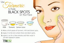 10 Home Remedies To Get Rid Of Dark Spots On Face Top 10 Home Remedies Facialmasks In 2020 Spots On Face Dark Spots On Face Black Spots On Face