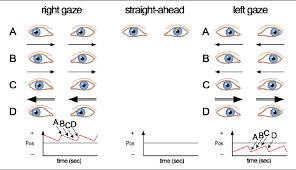 Image result for Motor Exam