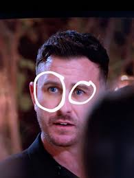 Nick's Eye Injury: Fight or Skateboarding Accident?