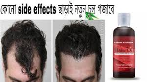 Kerala made miracle oil stops hair fall in 3 days & produce new hairs in less than 10 days. Best Of 10 Days Hair Oil Review Hindi Free Watch Download Todaypk