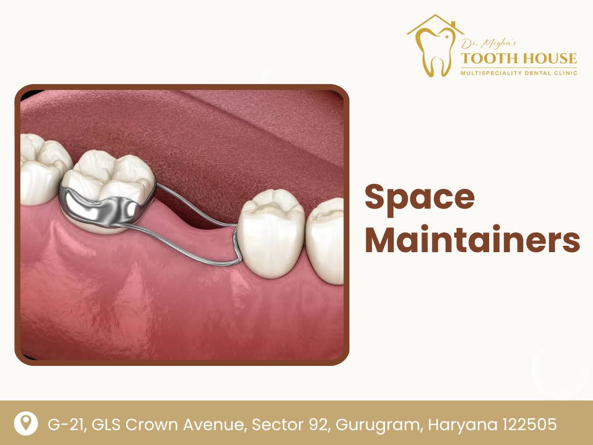 Space Maintainers product image