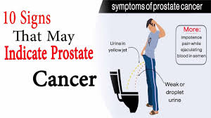 Causes and warning signs written by: Prostate Cancer Signs 10 Signs That May Indicate Prostate Cancer Youtube