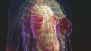 This can happen naturally as women get older, but it can also be caused by breast cancer because of this, doctors generally do not recommend pht if a woman was previously treated for breast cancer. Breast Cancer Women S Health Issues Msd Manual Consumer Version