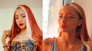 Foto Ruivinha De Marte Antes E Depois Da Harmoniza O Facial  Purepeoplesexiezpix Web Porn