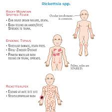 Image result for Rickettsialpox