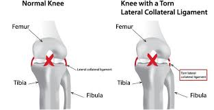 Pin On Sports Injury