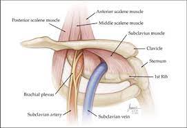 Thoracic Outlet Syndrome Treatment Symptoms Causes Diagnosis
