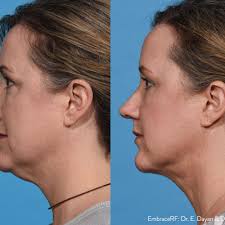 TOP 10 BEST Co2 Laser in Fort Myers, FL