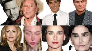 Chirurgies esthétiques ratées ou excessives : 19 célébrités méconnaissables  Avant-Après