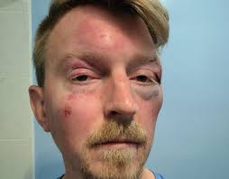 Arlington man assaulted while trying to break up dispute: police