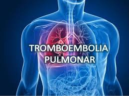 We did not find results for: Tromboembolia Pulmonar Ppt Descargar