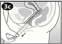 The vaginal ring must be inserted on the appropriate day and left in place for three consecutive weeks. These Highlights Do Not Include All The Information Needed To Use Nuvaring Safely And Effectively See Full Prescribing Information For Nuvaring Nuvaring Etonogestrel Ethinyl Estradiol Vaginal Ring Initial U S Approval 2001