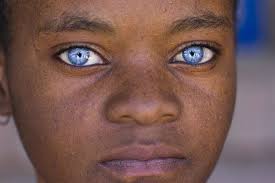 Blue eyes is possible in people with dark skin. African Americans With Green Grey Hazel Or Blue Eyes Naturally Blonde Or Red Ginger Hair And Freckles People With Blue Eyes Black Girl Blue Eyes Dark Skin Blue Eyes