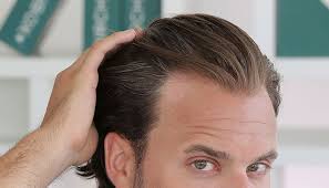 The Best Hairstyles For A Receding Hairline 2020 Haircut Styles Thining Hair Hairstyles For Thin Hair Prp Hair Treatment