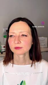 Actually remembered to take a video 🙈 No filter, no edit, just a stunning  set of Signature lips